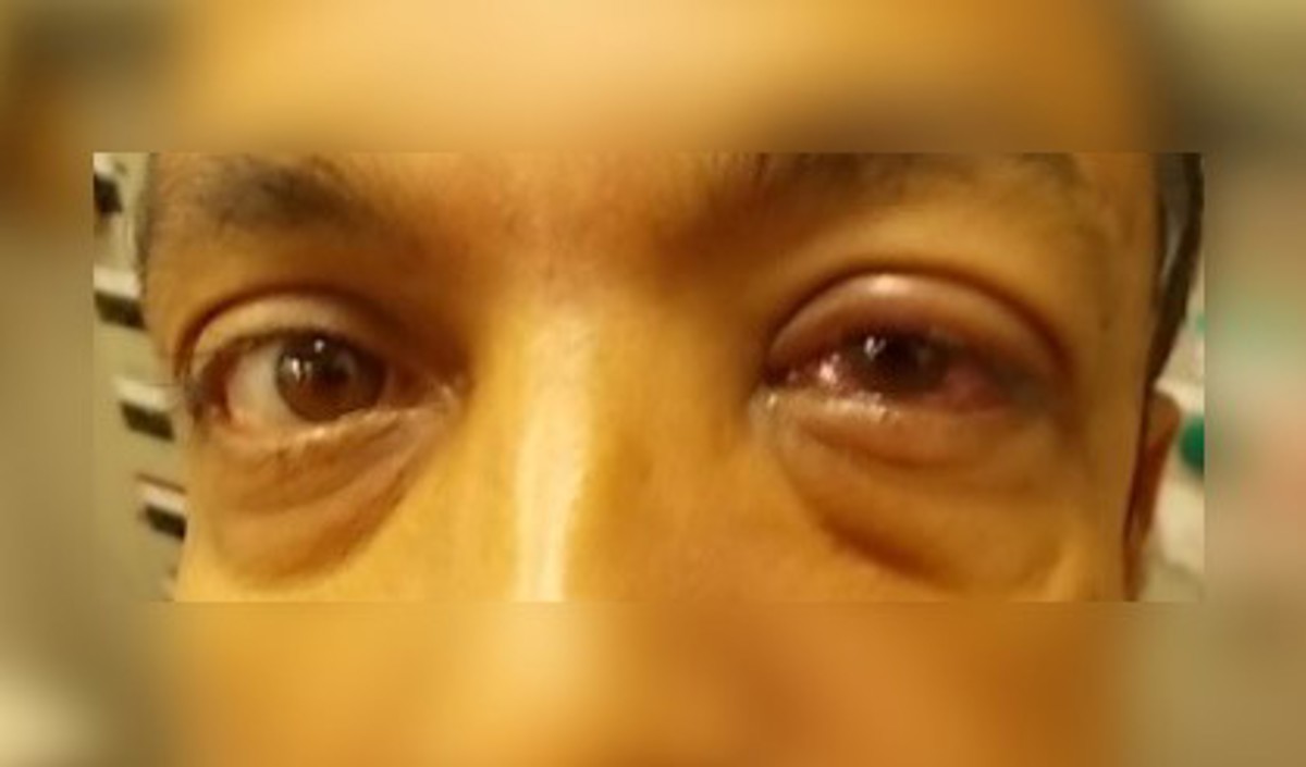 IMCA SF: Crewman got cement dust in his eyes 23178 During the discharging of a cement tank on board a vessel, a crewman was standing in the path of a blow back of cement dust, and the dust got in his eyes.