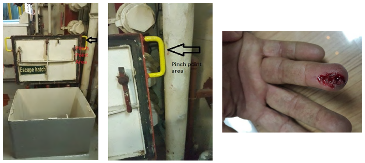 Escape hatch, pinch area and injured finger