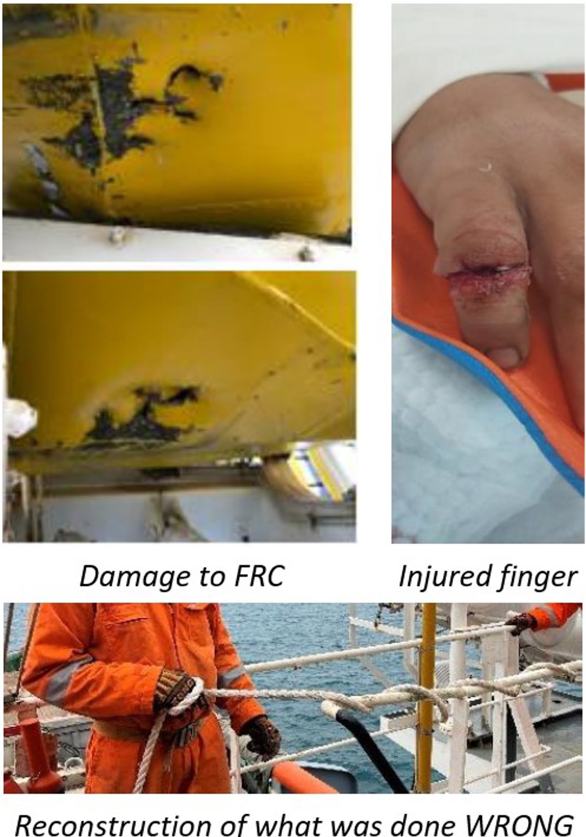 worker suffered a serious finger injury when his hand got caught between a  painter rope under tension and the handrail. The incident occurred during  testing of the rescue boat davit. He was holding the painter line, which was  hitched to the handrail, coiled around his right hand. During the  test, the winch brake system failed. This caused the FRC to fall. The  crew members’ hand was stuck between the painter rope and the  handrail. He suffered serious lacerations and compound fractures  to his finger.