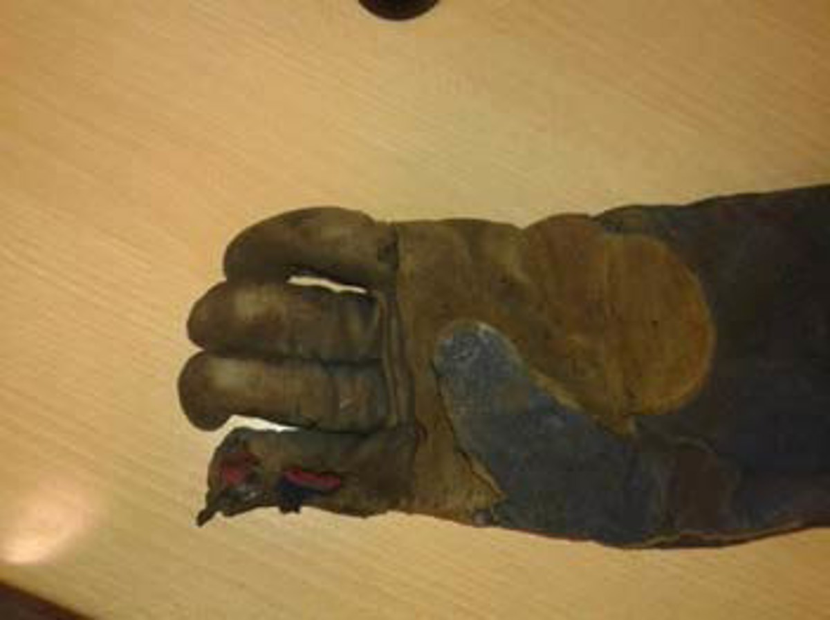 IMCA SF: ‘Routine’ task, non-routine result: Finger injury during welding Imcasf09 15 Image5 injury to hand