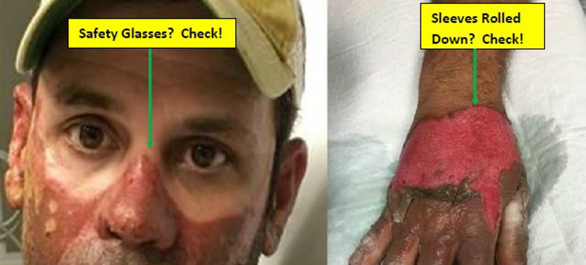 IMCA SF: How PPE works: Fire and thermal protection 121 BSEE considers that the proper use of appropriate PPE likely prevented additional injuries