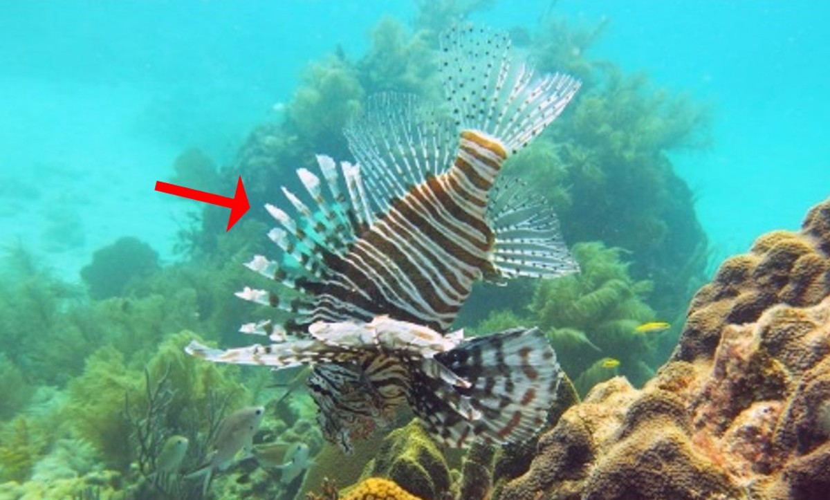 A diver suffered a finger injury from a Lionfish fin ray