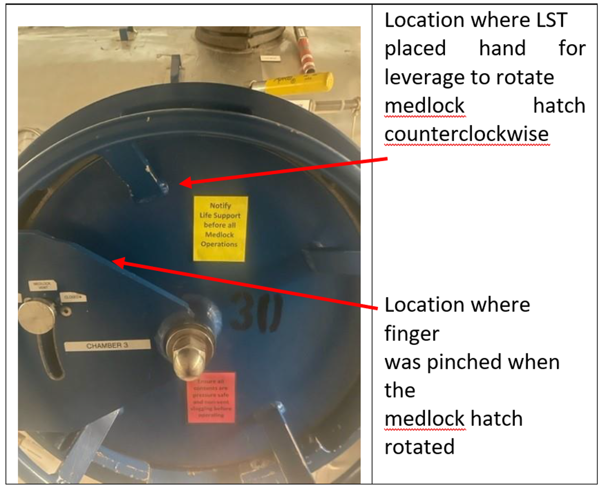 The hatch was stiff, and the LST had his fingers in the wrong place at the wrong time.